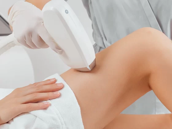 Laser Hair Removal